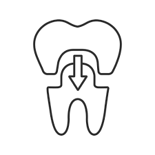 Restorations Restorations