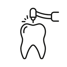 Root Canals Root Canals
